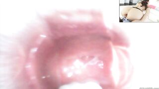 Casey Calvert gets her anus stretched with an anal speculum