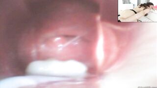 Casey Calvert gets her anus stretched with an anal speculum