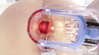 Casey Calvert gets her anus stretched with an anal speculum