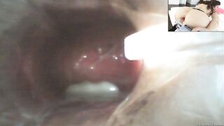 Casey Calvert gets her anus stretched with an anal speculum